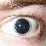 Мидриатики – капли расширяющие зрачки глаз