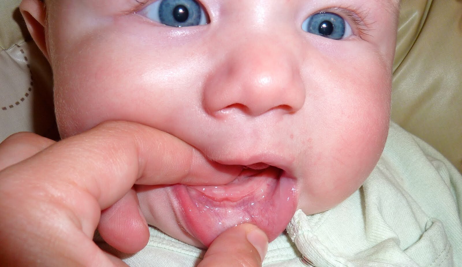 6 признаки зубов. Десны у новорожденных при прорезывании зубов. Десна при прорезывании зубика. Демна при прорезываниизубов.