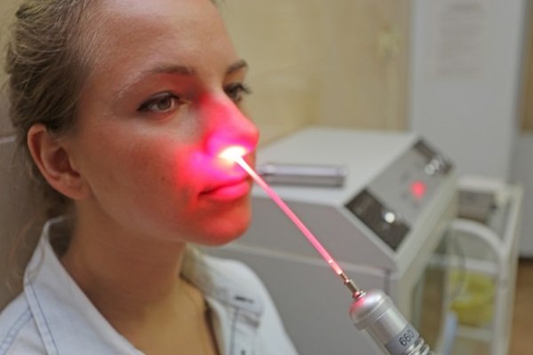 Сеанс лазерной фотодинамической терапии полости носа