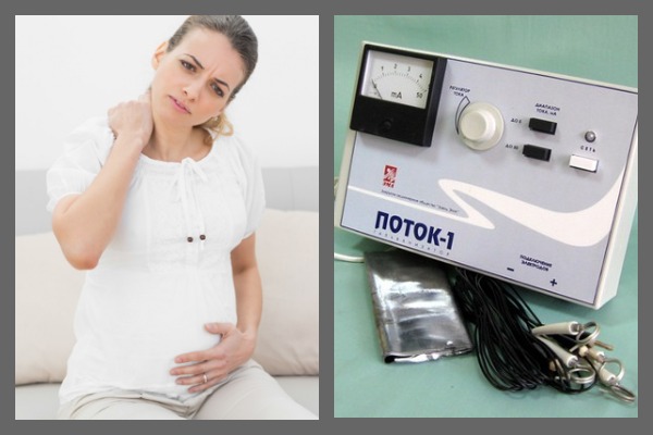 Решение о проведении электрофореза при беременности принимается индивидуально