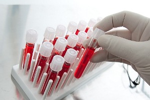 анализ крови для безопасности гирудотерапии