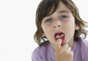 Что делать, если ребенок проглотил молочный зуб