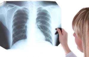 диагностика туберкулёзной интоксикации