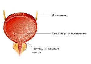 катетеризация мочевого пузыря