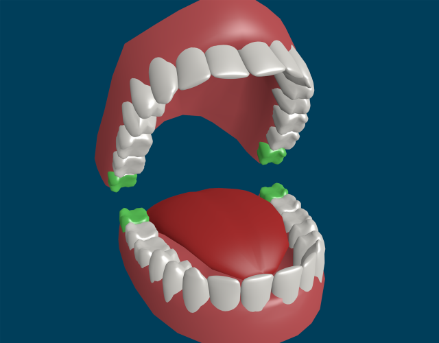 Страхи перед походом к стоматологу больно ли удалять зуб мудрости