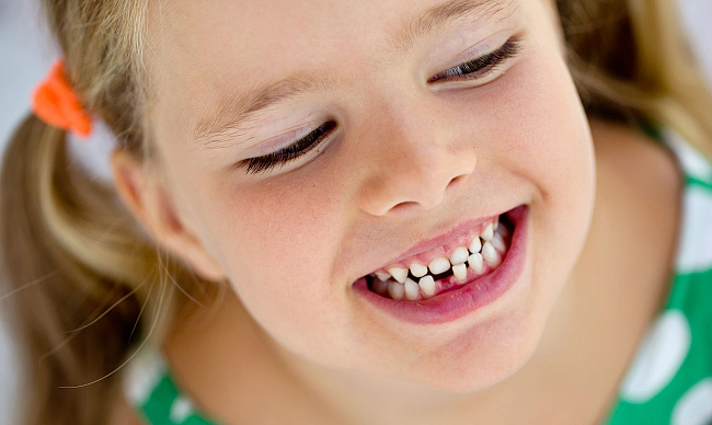 Важный вопрос есть ли корни у молочных зубов