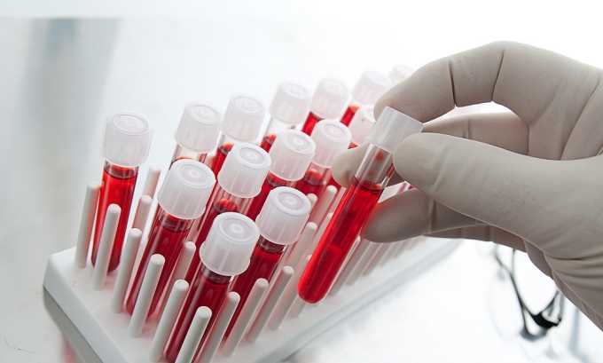 Биохимический анализ крови проводится для диагностики панкреатита