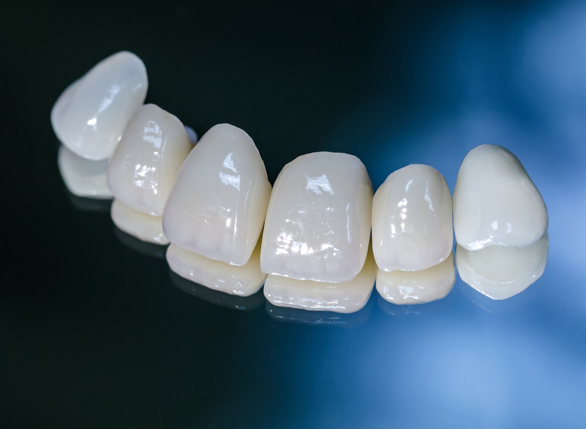 Коронки из металлокерамики на передние зубы фото