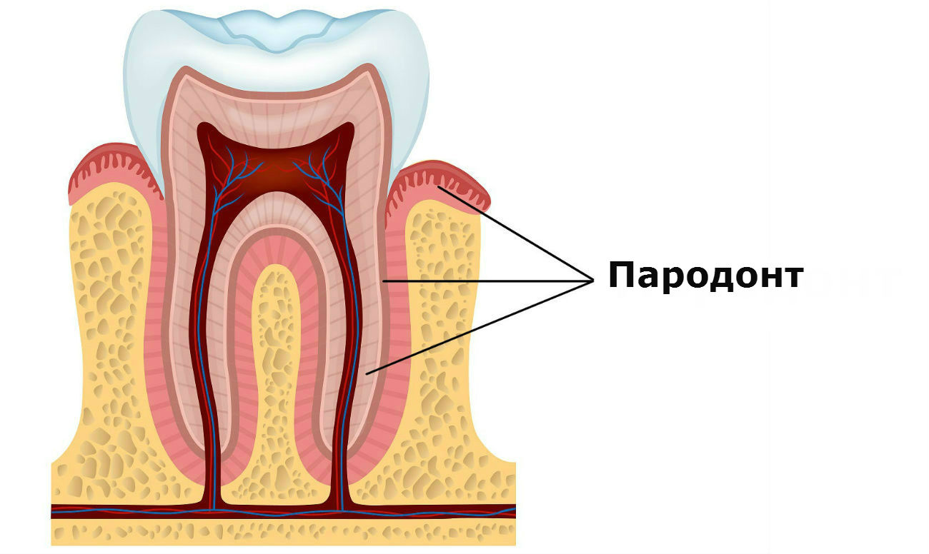 Лечение воспаления десневого кармана в стоматологии и в домашних условиях