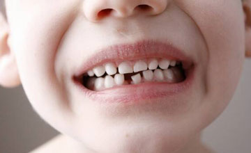 Все о молочных зубах у детей и взрослых