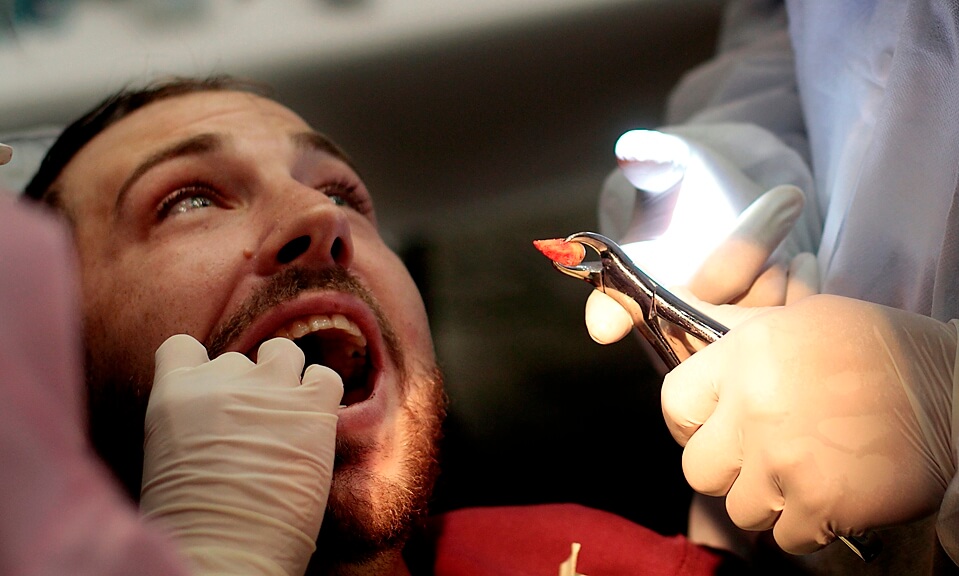 Протезирование после удаления зубов: через какое время можно ставить протез