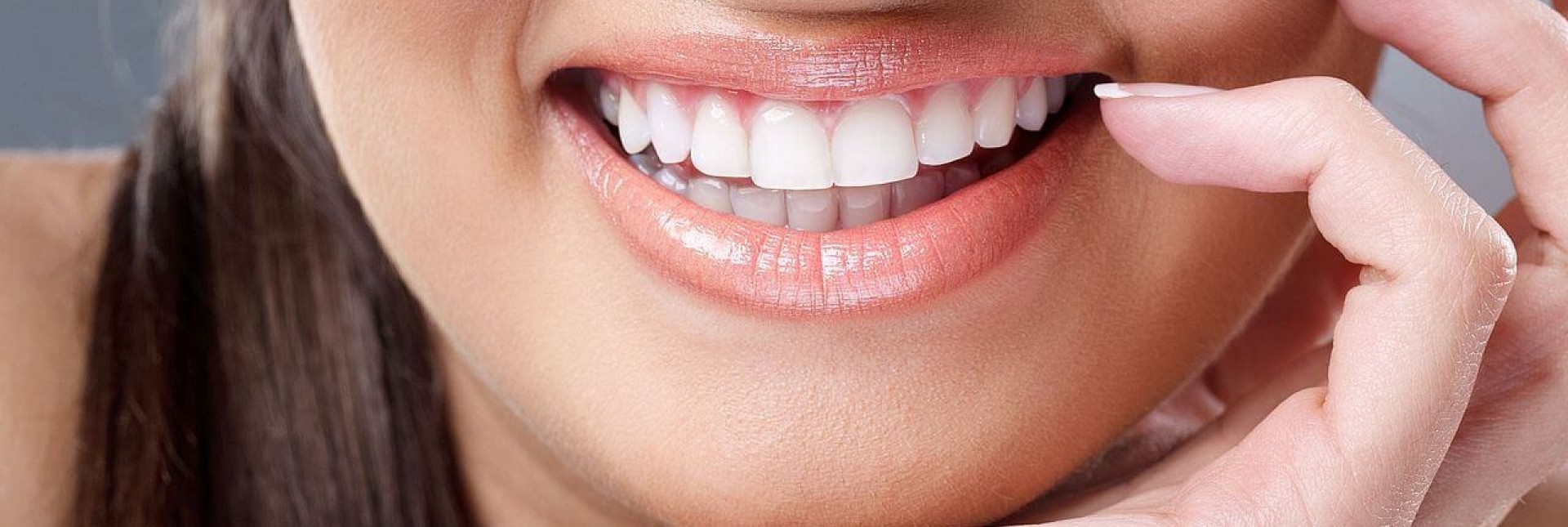 Что такое прямые или композитные виниры? Это способ недорого и быстро сделать зубы красивыми