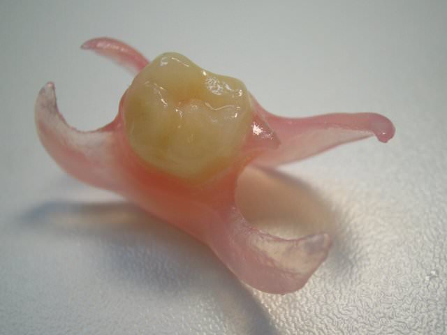 Что такое протезирование зубов. Виды съемных и несъемных протезов