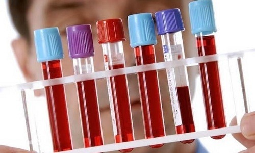 Биохимический анализ крови при панкреатите, являющийся важным методом исследования, назначается как при острой, так и при хронической форме патологии