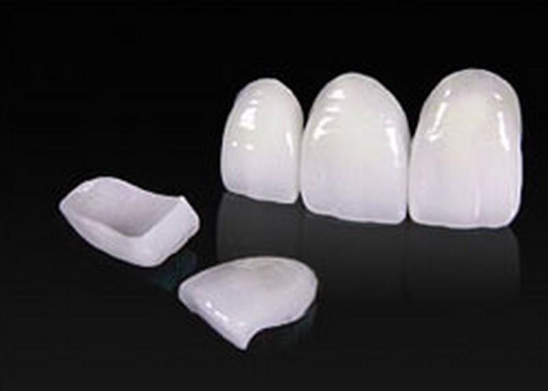 Особенности несъемных зубных протезов: противопоказания и правильный уход
