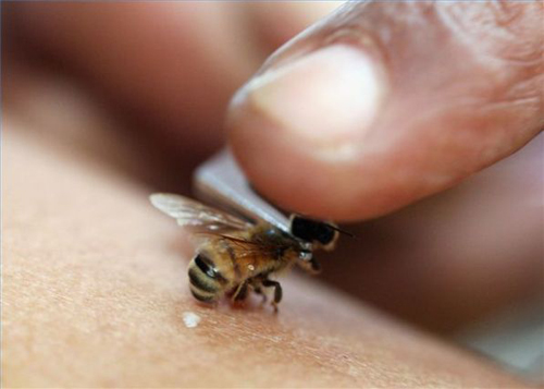 пчела оставляет жало при укусе