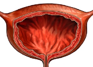 симптомы и лечение болезней мочевого пузыря