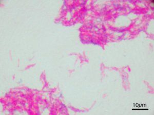 Бацилла Кальметта-Герена при микроскопическом увеличении