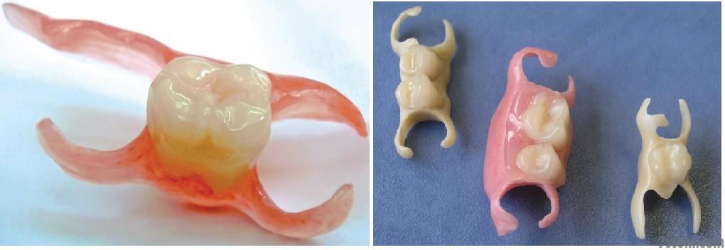 Протезирование после удаления зубов: через какое время можно ставить протез