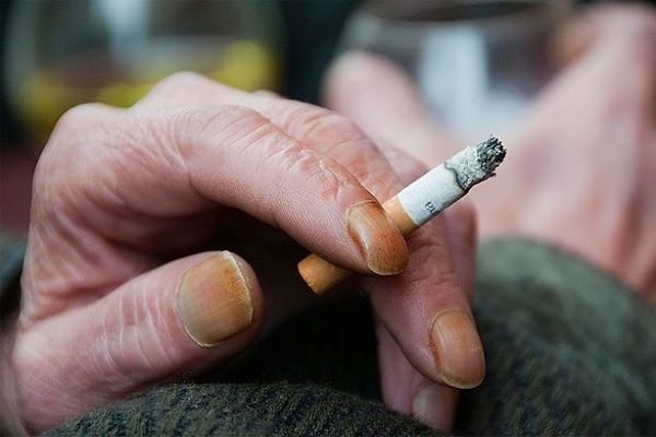 5 действенных способов, как убрать проблему желтых пальцев от сигарет из жизни курильщика