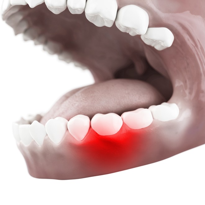 Почему болит зуб при нажатии на него? Возможные причины, и что с этим делать