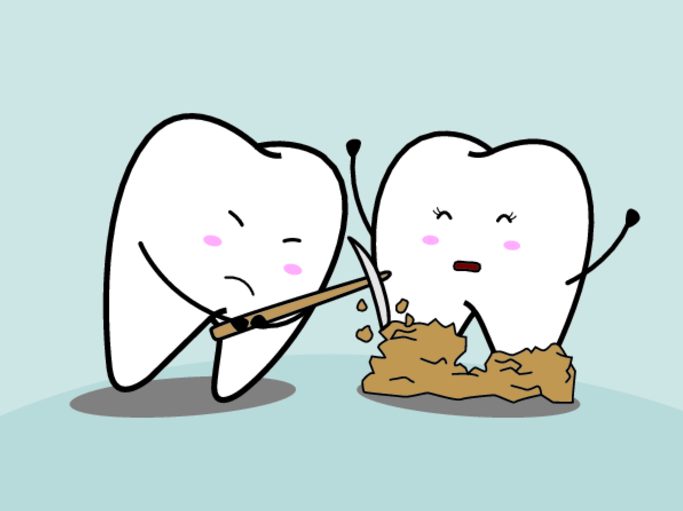 Как избавиться от зубного камня в домашних условиях. Четыре вида методов борьбы