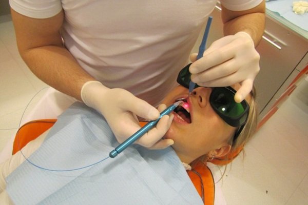 ФДТ успешно применяется стоматологами во всем мире