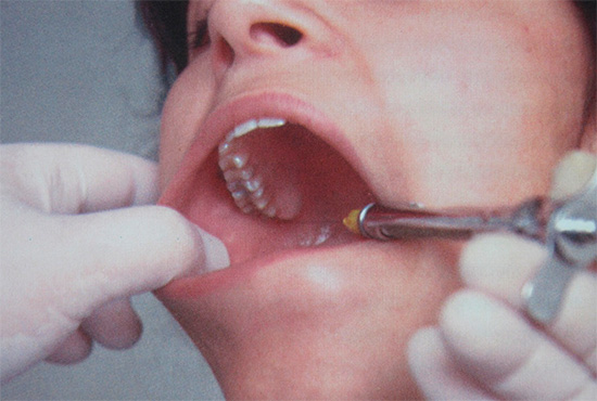Испытание для родителей удаление зубов у детей