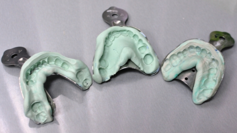 Что такое мягкие или гибкие зубные протезы. Преимущества и особенности ухода