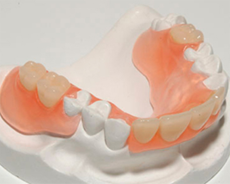 Преимущества и недостатки силиконовых зубных протезов. Три правила ухода