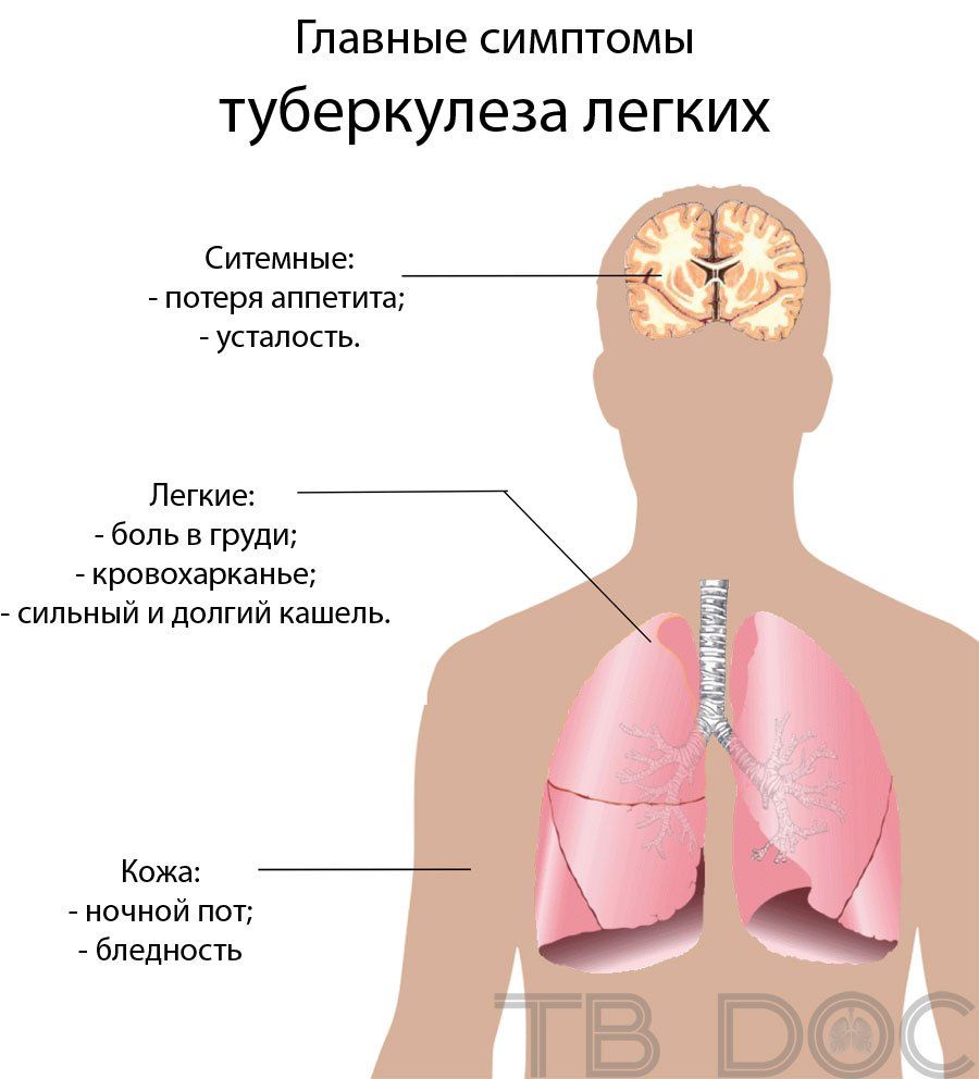 Основные симптомы туберкулеза легких