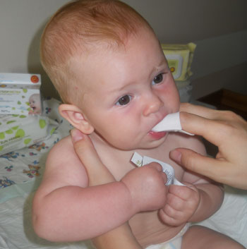 Появилась молочница у ребенка после антибиотиков. Чем лечить?