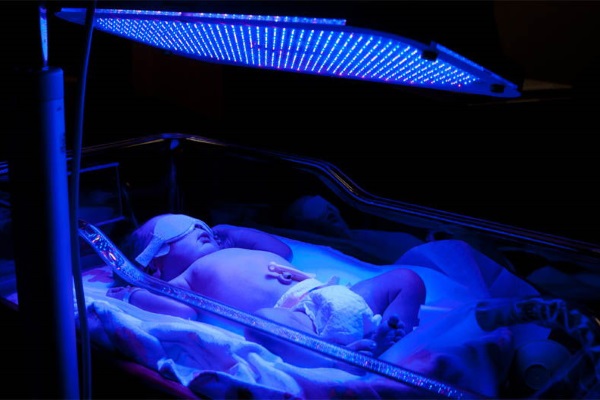 Фототерапия при желтухе у новорожденного