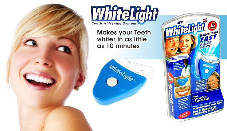 Выбираем лучшую систему для домашнего отбеливания зубов. Возможно ли достичь результата как в стоматологии