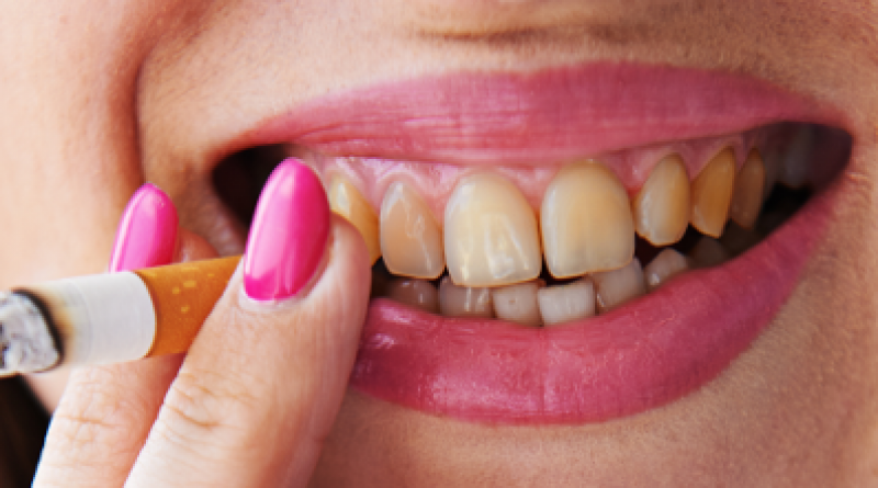 Почему у вас желтые зубы? Причины могут быть разными