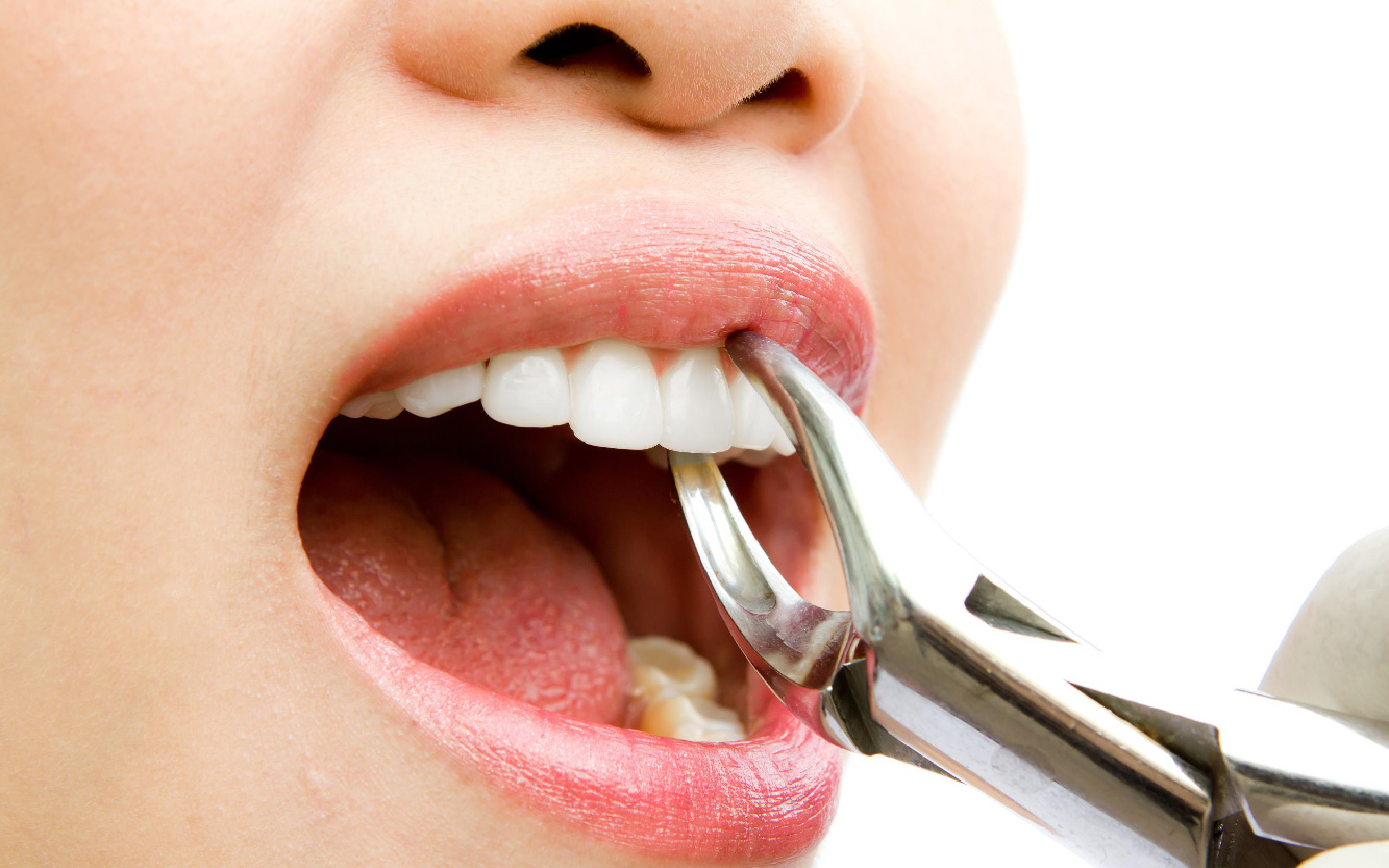 Что делать, если после удаления зуба болит десна. Как долго длится воспаление, и нормально ли это