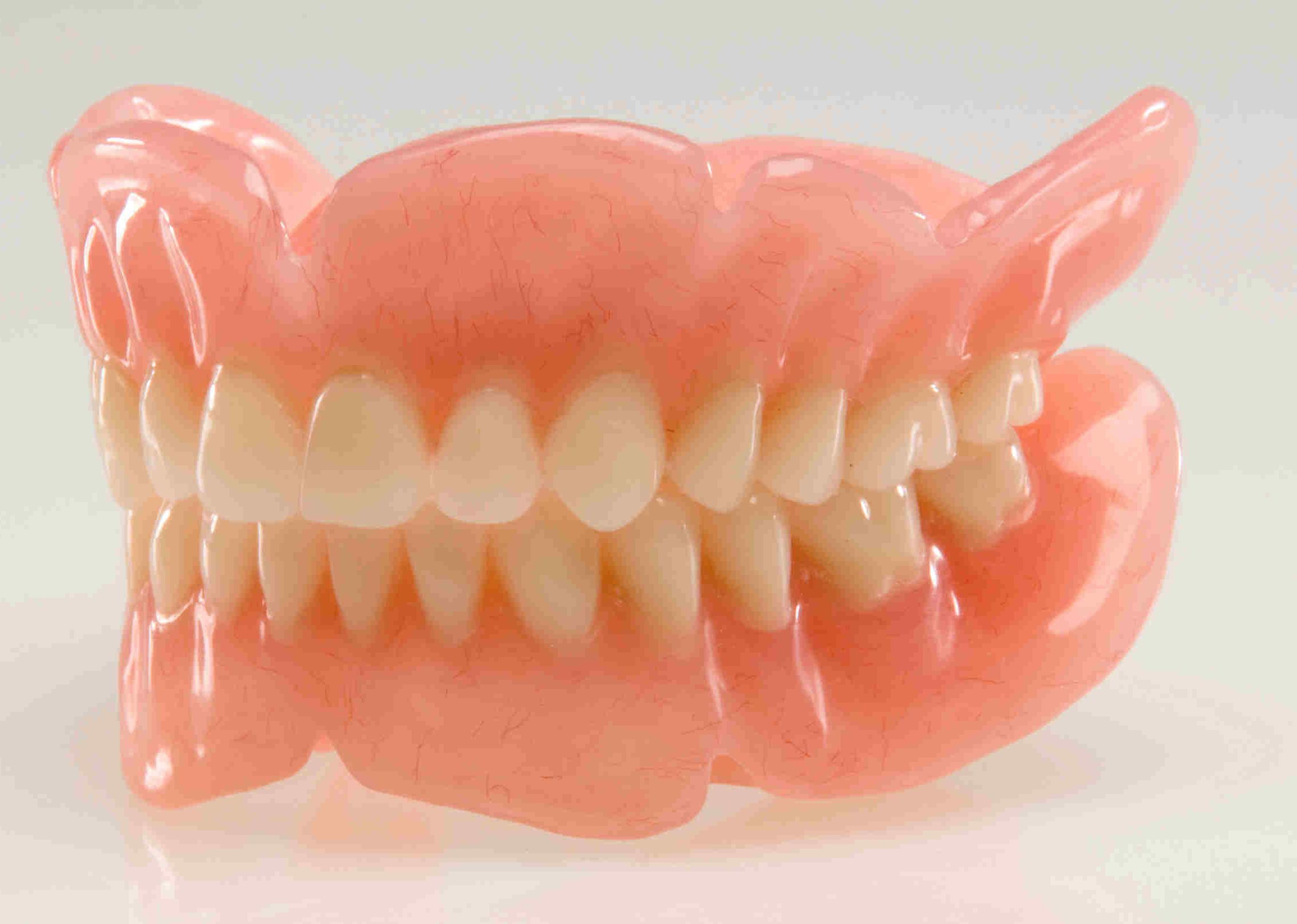 Особенности зубных протезов на присосках на один и несколько зубов