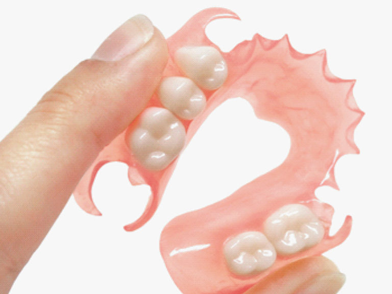 Что такое мягкие или гибкие зубные протезы. Преимущества и особенности ухода