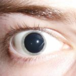 Мидриатики – капли расширяющие зрачки глаз