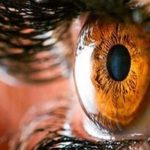 Дистрофия сетчатки глаза