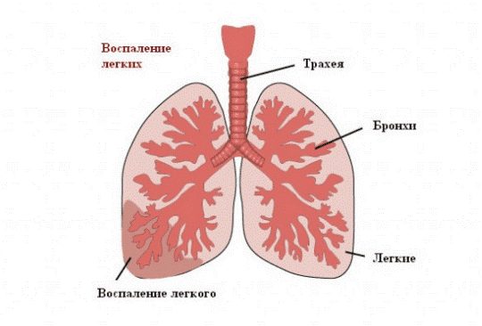 легкие