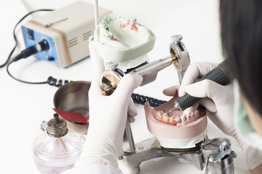 Преимущества и недостатки силиконовых зубных протезов. Три правила ухода