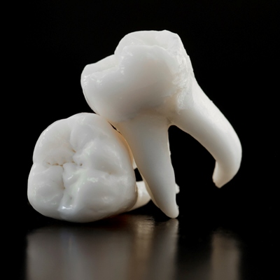 Важный вопрос есть ли корни у молочных зубов