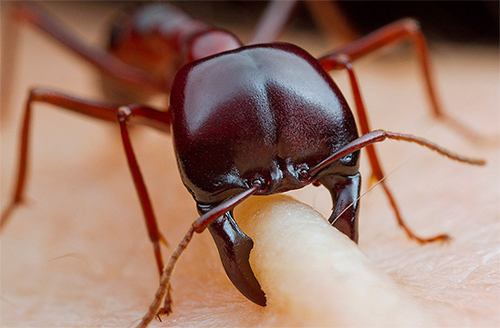 укус муравья фото поражения кожи