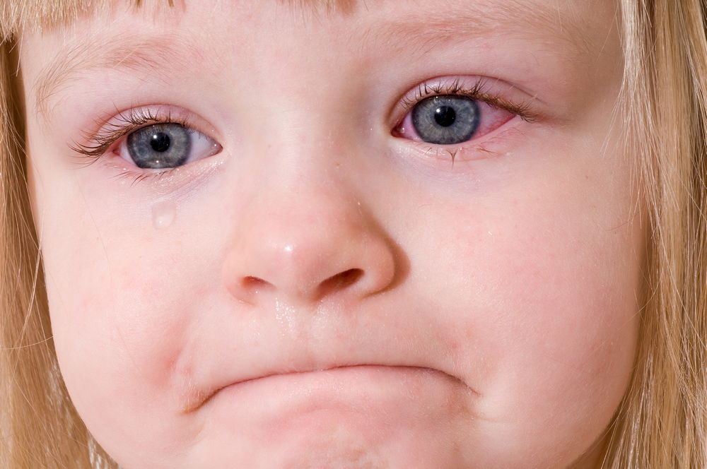Почему появляется молочница на губах у ребенка, и как её лечить