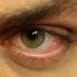 Почему глаза красные по утрам и как их лечить