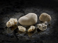 камни в почках