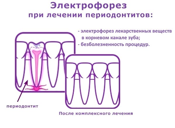 Электрофорез в стоматологии презентация